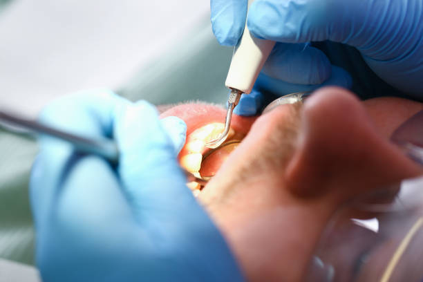 Best Cracked Tooth Emergency Dentist  in Fairfield, AL