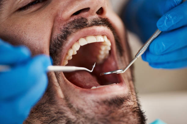 Best Urgent Tooth Repair  in Fairfield, AL